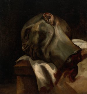 Head of a Guillotined Man by Theodore Gericault Oil Painting
