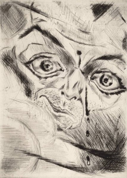 Main Product Photo of Peter with a Gunshot Wound in His Forehead  Painting by Walter Gramatte